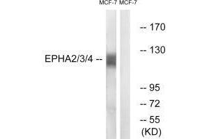 Western blot analysis of extracts from MCF7 cells, using EPHA2/3/4 (Ab-588/596) antibody. (EPH Receptor A2 anticorps  (Tyr588, Tyr596))