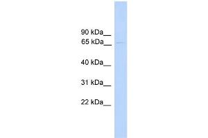 WB Suggested Anti-PAntibody Titration:  0. (PARP6 anticorps  (N-Term))