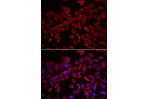 Immunofluorescence analysis of HeLa cell using CSRP3 antibody. (CSRP3 anticorps)