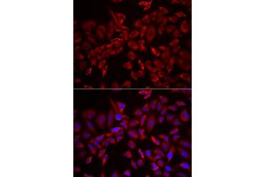 Immunofluorescence analysis of HeLa cell using CSRP3 antibody.