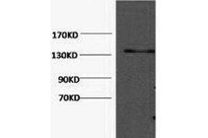 Western Blot analysis of Hela cells using COL3A1 Monoclonal Antibody at dilution of 1:1000.