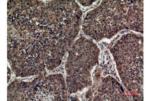 Immunohistochemistry (IHC) analysis of paraffin-embedded Human Lung, antibody was diluted at 1:100. (STX1A anticorps  (Internal Region))