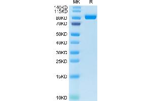 Cynomolgus FAP on Tris-Bis PAGE under reduced condition.