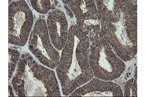 Image no. 2 for anti-Family with Sequence Similarity 164, Member A (FAM164A) antibody (ABIN1498198) (FAM164A anticorps)