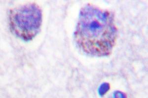 Image no. 1 for anti-Ribosomal Protein S6 Kinase, 70kDa, Polypeptide 1 (RPS6KB1) antibody (ABIN272052) (RPS6KB1 anticorps)