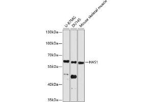 Western blot analysis of extracts of various cell lines, using H antibody (ABIN6129577, ABIN6141611, ABIN6141612 and ABIN6214712) at 1:1000 dilution.