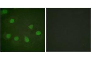 Immunofluorescence analysis of HeLa cells, using Retinoblastoma (Ab-249) Antibody. (Retinoblastoma Protein (Rb) anticorps  (AA 211-260))