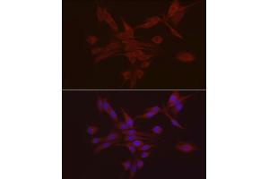 Immunofluorescence analysis of PC-12 using S100 antibody (ABIN7270123) at dilution of 1:25 (40x lens).