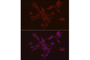 Immunofluorescence analysis of PC-12 using S100 antibody (ABIN7270123) at dilution of 1:25 (40x lens). (S100A10 anticorps  (AA 1-97))