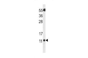 Western blot analysis of SH3BGRL3 Antibody in Neuro2a cell line lysates (35ug/lane)