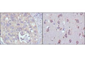 Immunohistochemical analysis of paraffin-embedded human lung cancer (left) and human brain (right) tissues using MPS1 mouse mAb with DAB staining. (Mps1 anticorps)