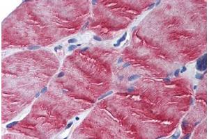 Human Skeletal Muscle (formalin-fixed, paraffin-embedded) stained with MYO5B antibody ABIN305726 at 2. (MYO5B anticorps  (N-Term))