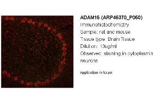 Image no. 2 for anti-ADAM Metallopeptidase Domain 15 (ADAM15) (Middle Region) antibody (ABIN2782601) (ADAM15 anticorps  (Middle Region))