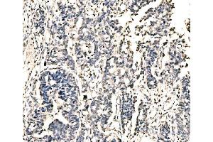IHC analysis of KI/VIRMA using anti-KI/VIRMA antibody (ABIN7599707). (Protein Virilizer Homolog (VIRMA) (AA 11-1529) anticorps)