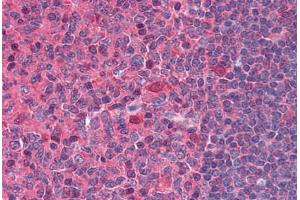 Human Tonsil: Formalin-Fixed, Paraffin-Embedded (FFPE)