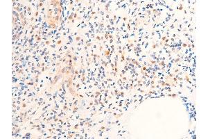 ABIN6267073 at 1/100 staining rat appendiceal tissue sections by IHC-P. (CHEK1 anticorps  (pSer280))