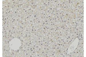 ABIN6274798 at 1/100 staining Mouse liver tissue by IHC-P. (ACSS1 anticorps  (C-Term))