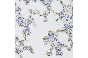 Immunohistochemistry of paraffin-embedded rat lung using HNRNPD Antibody.