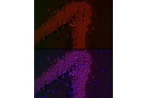 Immunofluorescence analysis of mouse brain cells using NeuN Rabbit mAb (ABIN7270098) at dilution of 1:100 (40x lens). (NeuN anticorps)