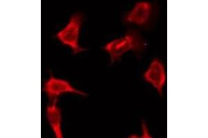 ABIN6276197 staining HeLa by IF/ICC. (OR9Q2 anticorps  (C-Term))
