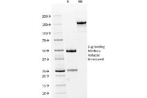 SDS-PAGE Analysis Purified RCC Mouse Monoclonal Antibody (66. (CA9 anticorps)