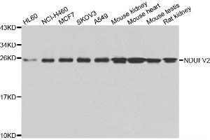 Western blot analysis of extracts of various cell lines, using NDUFV2 antibody (ABIN5975536) at 1/1000 dilution. (NDUFV2 anticorps)