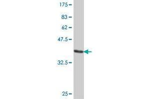 Western Blot detection against Immunogen (37.