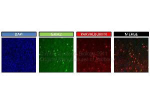 Primary Antibodies Brain slices were incubated overnight in a solution of PBST (0.