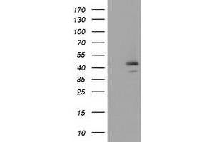 Image no. 1 for anti-serpin Peptidase Inhibitor, Clade B (Ovalbumin), Member 4 (SERPINB4) antibody (ABIN1500890) (SERPINB4 anticorps)
