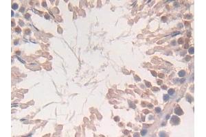 Detection of CYGB in Rat Testis Tissue using Polyclonal Antibody to Cytoglobin (CYGB)