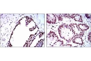 Immunohistochemistry (IHC) image for anti-Replication Protein A1, 70kDa (RPA1) antibody (ABIN1108896)