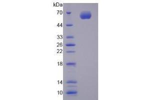 Image no. 1 for Cytochrome P450, Family 1, Subfamily A, Polypeptide 1 (CYP1A1) (AA 251-521) (Active) protein (His tag,GST tag) (ABIN6239867)