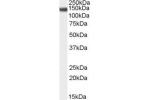Western Blotting (WB) image for anti-Abhydrolase Domain Containing 17C (ABHD17C) (Middle Region) antibody (ABIN2791515)