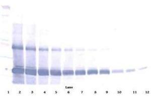 Image no. 3 for anti-AIMP1 / EMAP II antibody (ABIN465272) (AIMP1 / EMAP II anticorps)