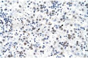 Immunohistochemical staining (Formalin-fixed paraffin-embedded sections) of human liver with FECH polyclonal antibody  at 4-8 ug/mL working concentration. (FECH anticorps  (N-Term))