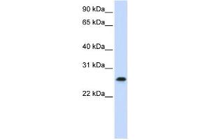 Western Blotting (WB) image for anti-PHD Finger Protein 19 (PHF19) antibody (ABIN2459399) (PHF19 anticorps)
