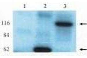 Western blot analysis using anti-Lfc antibody on HEK-293 cell transfected with vector alone (1), lfc-short (2) and lfc-long (3). (ARHGEF2 anticorps)