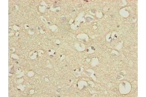 Immunohistochemistry of paraffin-embedded human brain tissue using ABIN7151390 at dilution of 1:100