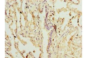 Immunohistochemistry of paraffin-embedded human lung tissue using ABIN7170672 at dilution of 1:100 (SLA anticorps  (AA 2-276))