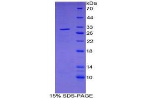 SDS-PAGE analysis of Human PDP Protein. (PDP Protéine)