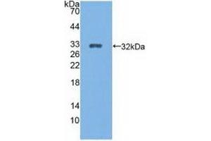 Detection of Recombinant CYP27B1, Rat using Polyclonal Antibody to Cytochrome P450 27B1 (CYP27B1) (CYP27B1 anticorps  (AA 251-500))