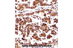 Immunohistochemistry (IHC) image for anti-Origin Recognition Complex, Subunit 3 (ORC3) antibody (ABIN2998313) (ORC3 anticorps)