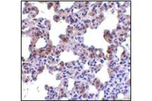 Immunohistochemistry of PEN2 in rat lung tissue with this product at 2. (PEN2 anticorps  (N-Term))