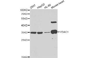 Western blot analysis of extracts of various cell lines, using VDAC1 antibody. (VDAC1 anticorps)