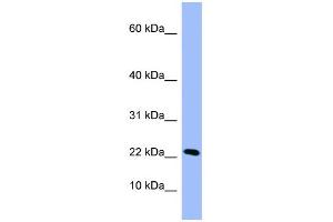 WB Suggested Anti-PIN4 Antibody Titration: 0.