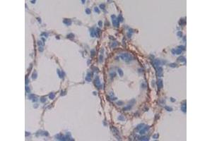 Figure. (ESAM anticorps  (AA 31-251))