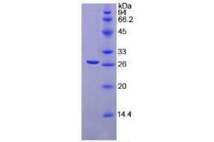 SDS-PAGE analysis of Mouse TGFbI Protein. (TGFBI Protéine)