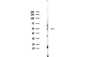 Western blot analysis of lysates from A2780 cells(starvation 24h treatment), using CHST3 Antibody at 1/1000 dilution. (CHST3 anticorps  (C-Term))