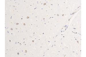 ABIN6267267 at 1/100 staining human heart tissue sections by IHC-P.