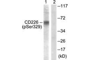 Western blot analysis of extracts from COS7 cells, using CD226/DNAM-1 (Phospho-Ser329) Antibody. (CD226 anticorps  (pSer329))